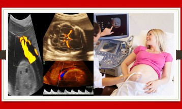 Fetal Color doppler