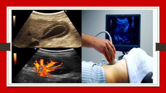 Abdominal Ultra Sonography