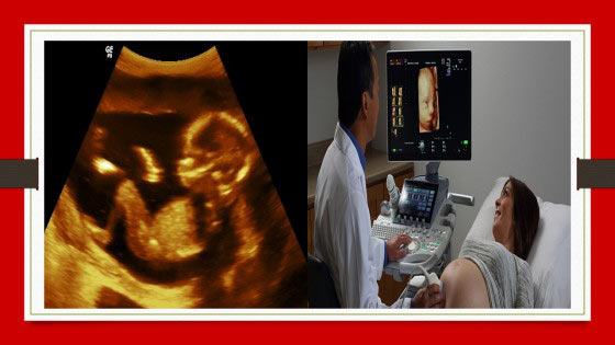 Detailed Fetal Sonography